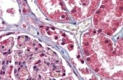 GFPT1 Antibody, Novus Biologicals 50 &mu;g | Buy Online | Novus Biologicals | Fisher Scientific